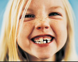 Children's Teeth