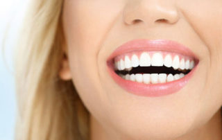 dental crowns and bridges