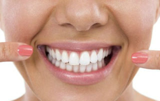 Whitening Treatments